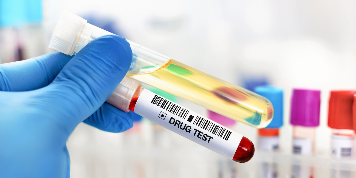Urine Drug Screening